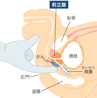 男のディルドアナニー入門！初心者にもおすすめのやり方を解説｜風じゃマガジン