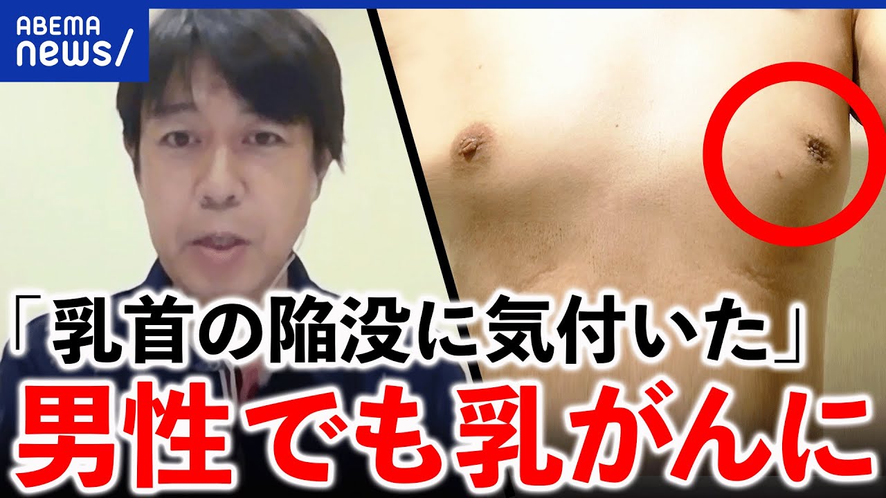 男性の乳頭縮小