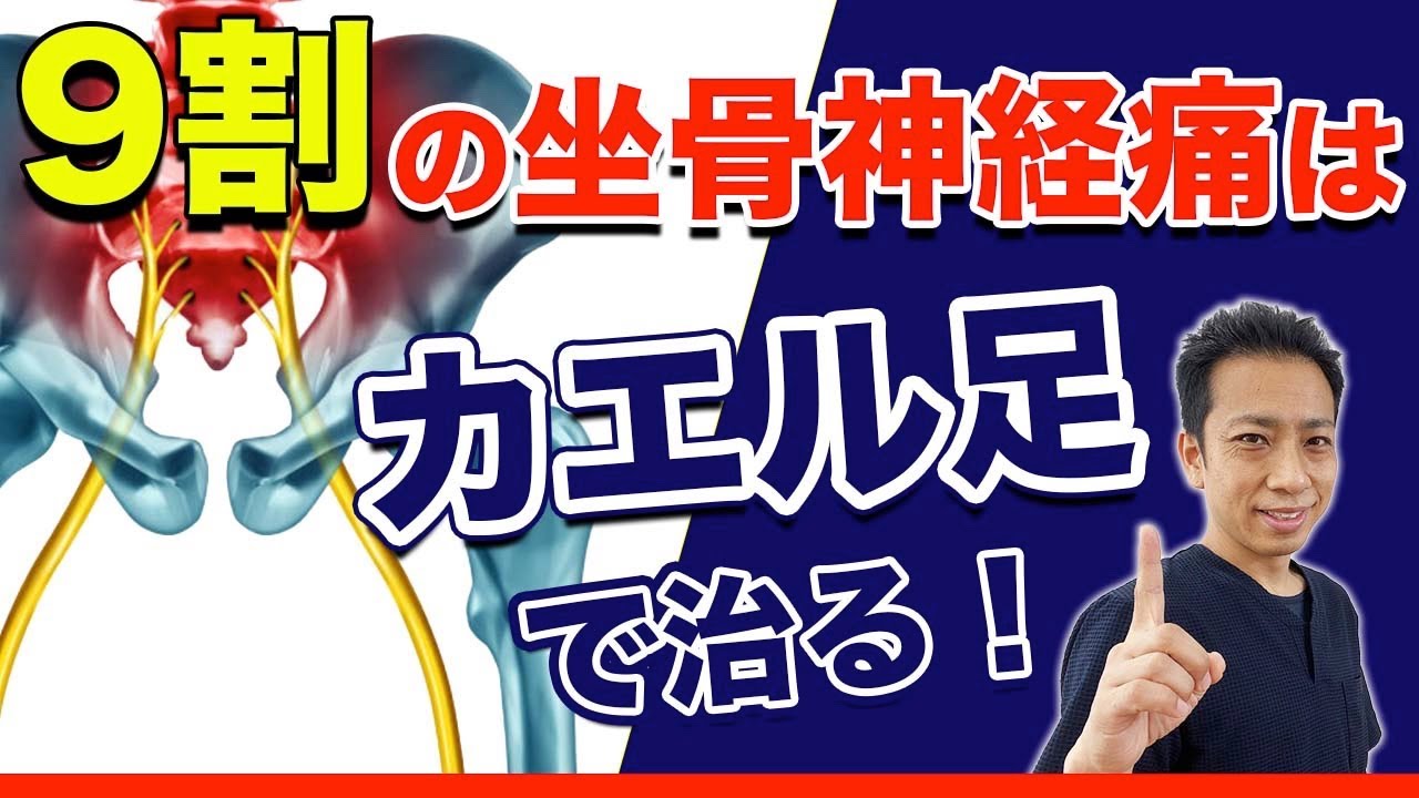 【坐骨神経痛 改善】9割の坐骨神経痛は”カエル足”で治る！