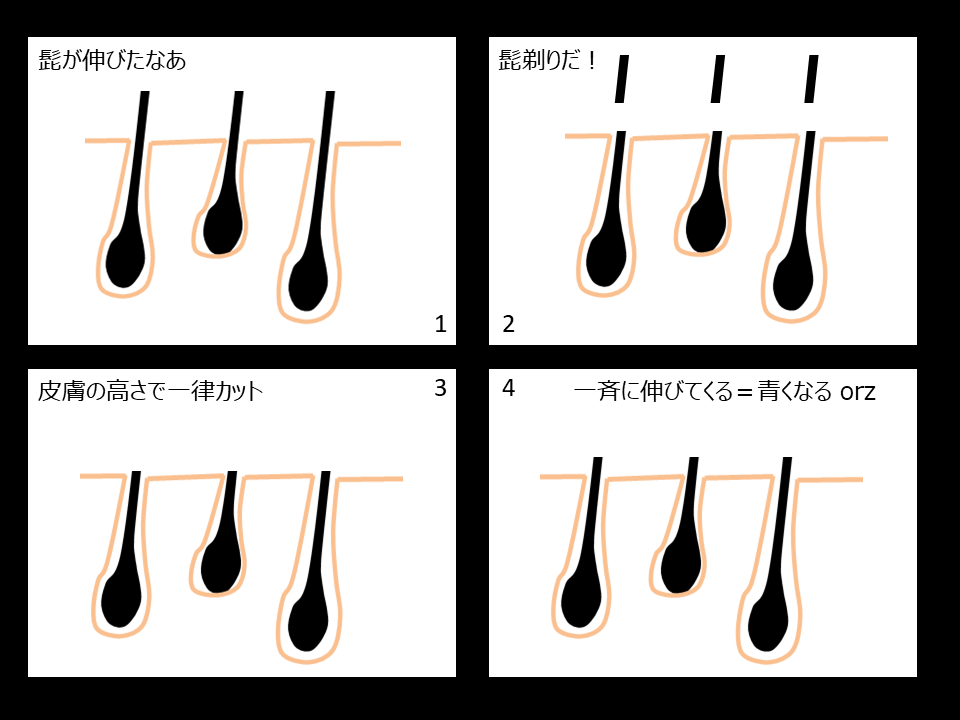 ヒゲ女子【必読】憎いムダ毛を仕留めるパーフェクトな対処法 | 医療脱毛のジュエルクリニック恵比寿【公式】