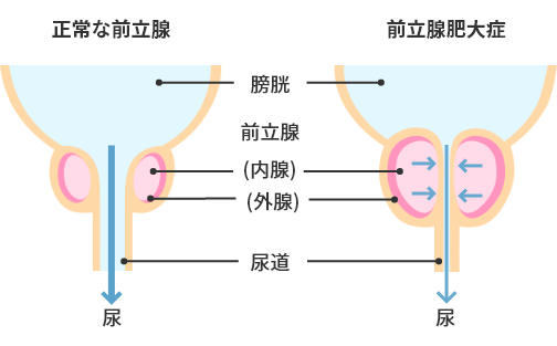 はじめての緊縛SM調教 終わらない前立腺イキ地獄 - honto電子書籍ストア