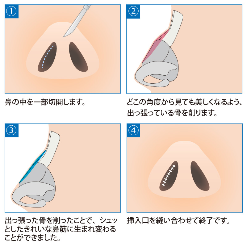 淫爆 / 沢里裕二