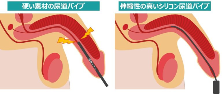 前庭球の刺激でイカせる！クリトリスや膣だけに頼らない新常識 – メンズ形成外科