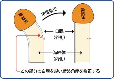 下反りのおち○ぽってどうなの！？意外なメリットを語りました♡