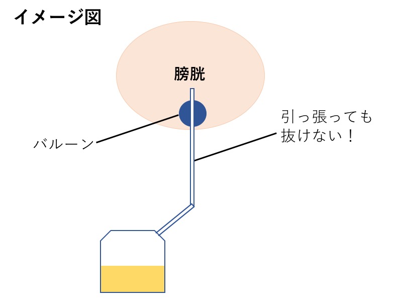 ガイドラインに基づいた前立腺肥大症の正しい知識と治し方 | 同友会メディカルニュース