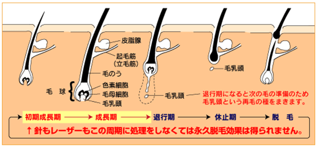 毛を抜く」自己処理はNG！脱毛中にムダ毛をなくす正しい処理方法 | メンズ脱毛百科事典 リンクスペディア