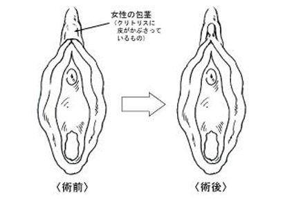 婦人科（女性器）/仙台中央クリニック