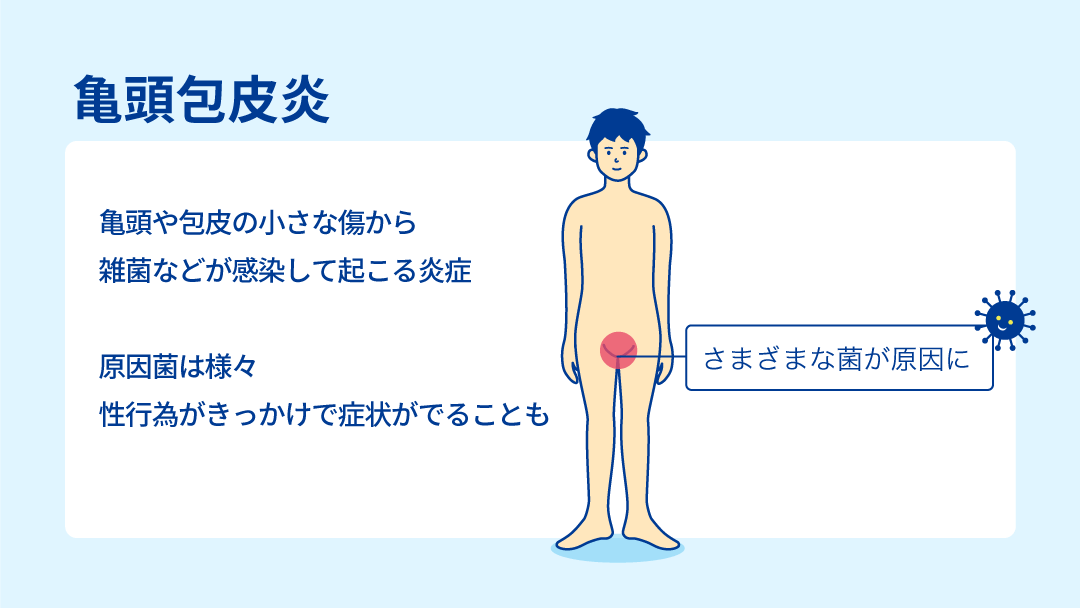 おちんちんが痛い、腫れている（原因、病気、何科、治療）｜神戸市東灘区のいしむら腎泌尿器科クリニック