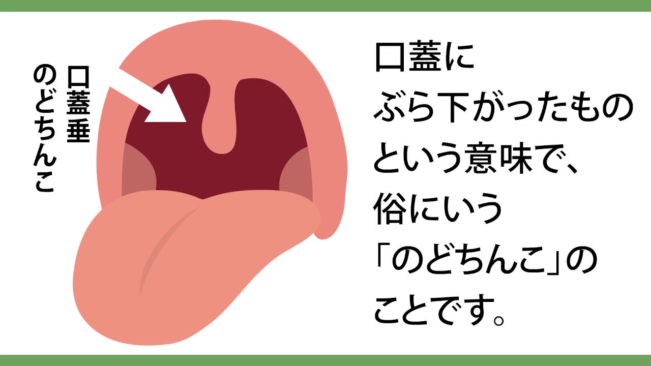 扁桃炎・咽頭炎・喉頭炎について｜横浜市都築区のおおた耳鼻咽喉科