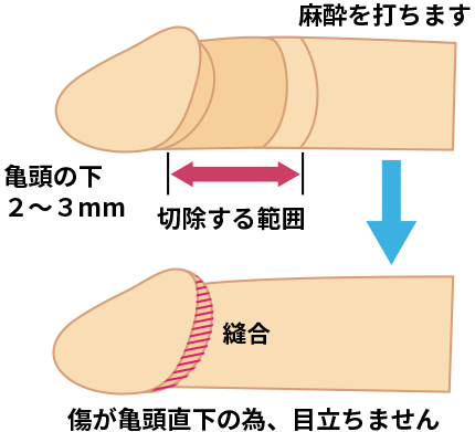 切迫早産の原因や特徴、診断は？過ごし方や予防のためのポイント ｜ 子育て応援サイト 教えてトイザらス・ベビーザらス