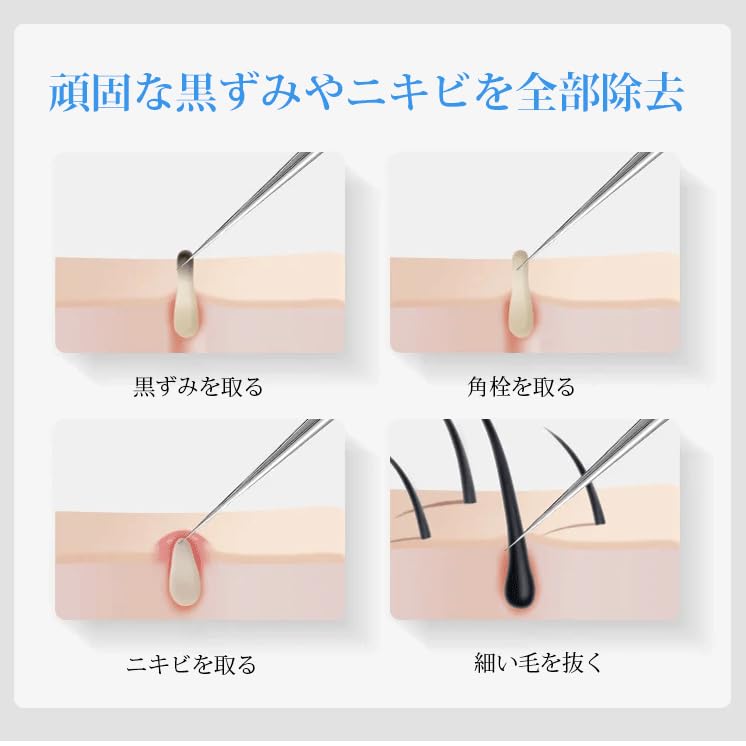 ヒゲを抜き続けると肌がボロボロに！確実にヒゲの悩みを解決する方法 | メンズ脱毛百科事典