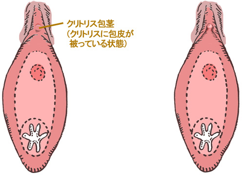 クリトリスにも勃起や包茎がある？ 仕組みやチェック方法を解説 ｜ iro