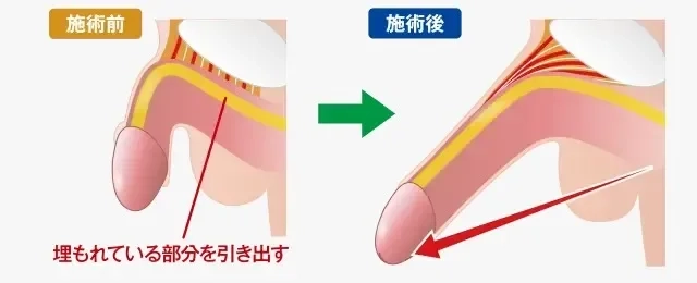 【1日5分】ちんちんを少しだけ増大させましょう