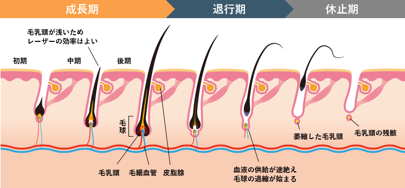 ヒゲ脱毛｜メンズ(男性)の医療脱毛・医療レーザー脱毛なら湘南美容クリニック【公式】｜美容整形・美容外科