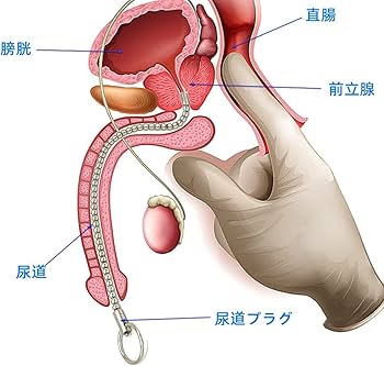 尿道責めの方法と注意点 - 液体注入編(ゼリーはこちら) 2nd