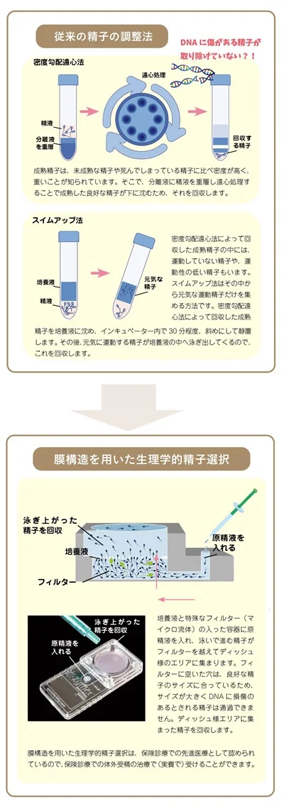 ブリーフ・長風呂…不妊を招きかねない男の習慣 男性不妊症の実態と治療法（前編） -