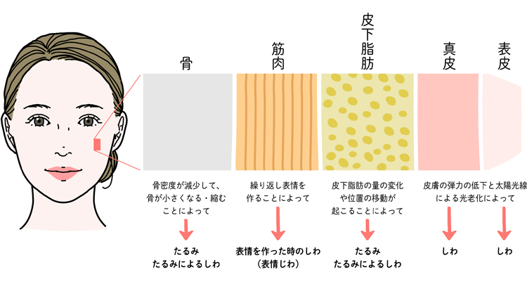 アンチエイジングでメンズにおすすめの治療は？老け顔に見える原因や見直すべき習慣も解説します | 今泉スキンクリニック