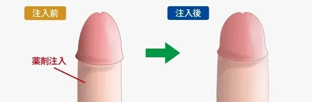 ちんこトイレットペーパーチャレンジで簡単にサイズ測定しよう！