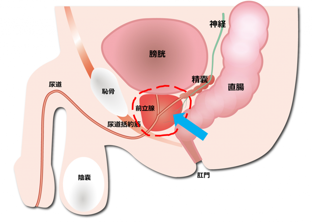 前立腺とは？｜前立腺がんについて｜What's? 前立腺がん