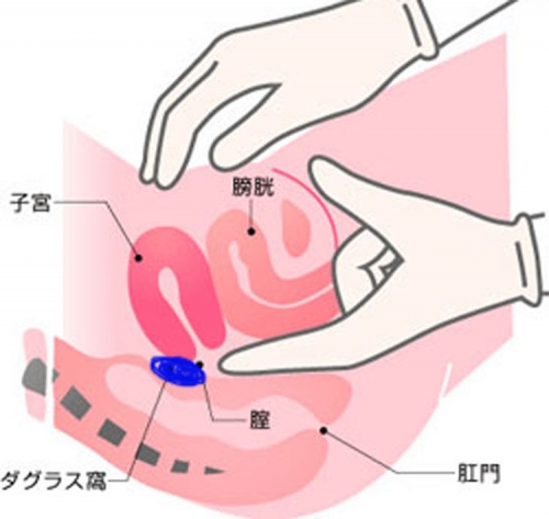 子宮筋腫の原因は性行為のやりすぎ？その症状・検査治療法・性行為や妊娠等の悩みを女医が丁寧に解説。 – 