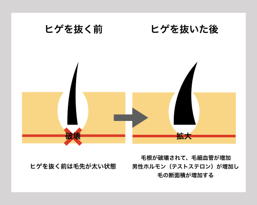 髭を抜くと生えてこなくなるって本当？デメリットや自己処理方法も解説 - OZmall