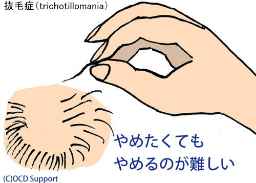 子供の噛みつき」が直らない！どう対応したらいい？経験者ママ・保育士さん…みんなの答えは？（まめねこ） - エキスパート -