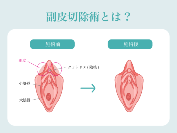 乙骨えちた on X: 