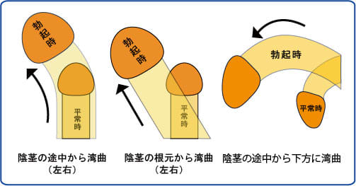 ちんこが大きくなる食材決定版！簡単に作れるレシピも！ | Trip-Partner[トリップパートナー]