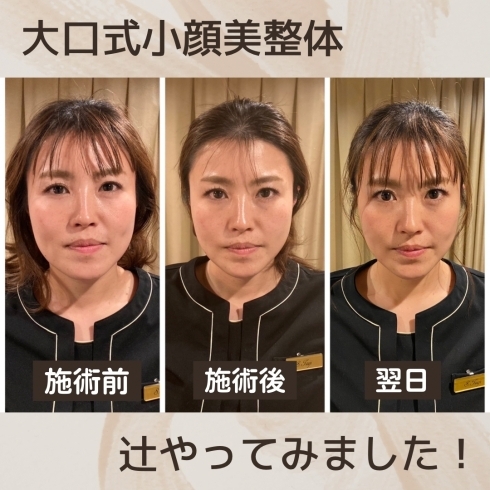 小顔 エステ 体験 今日に関するサロン Facial