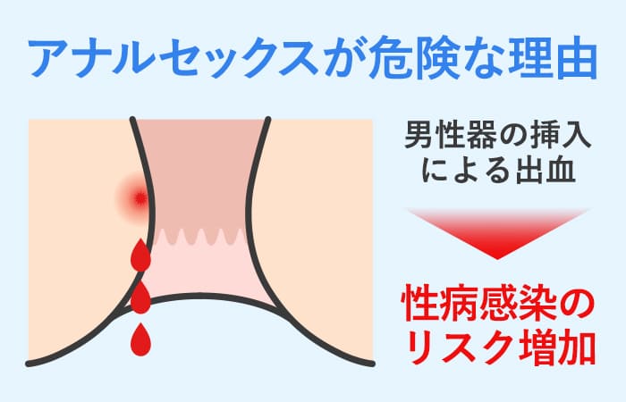 アナルセックスって気持ちいいの？ 経験者に聞いてみた | オトナのハウコレ