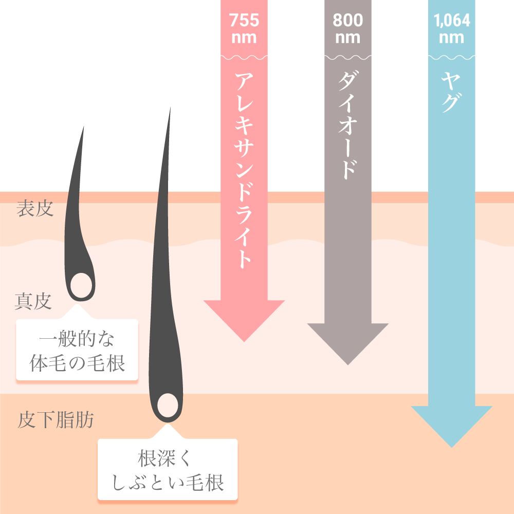 睾丸（玉袋）周辺の毛は処理すべき？メリットやデメリット、根本的な解決方法も解説│メンズジェニー