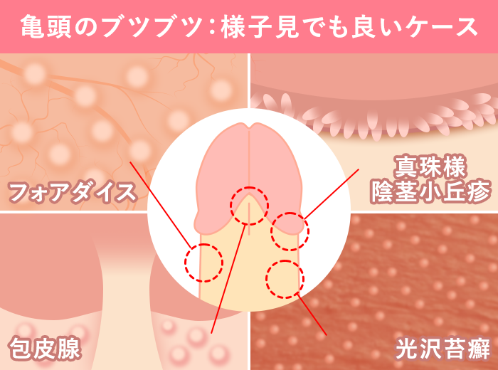 女王様】チンコを生やした女王様が2人の奴隷と3P！挿れて挿れられイカせてイカされる - 動画エロタレスト