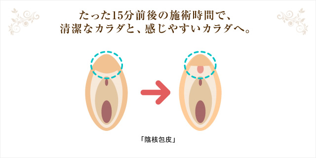 小陰唇縮小・手術｜京都の美容外科すなおクリニック(四条河原町)