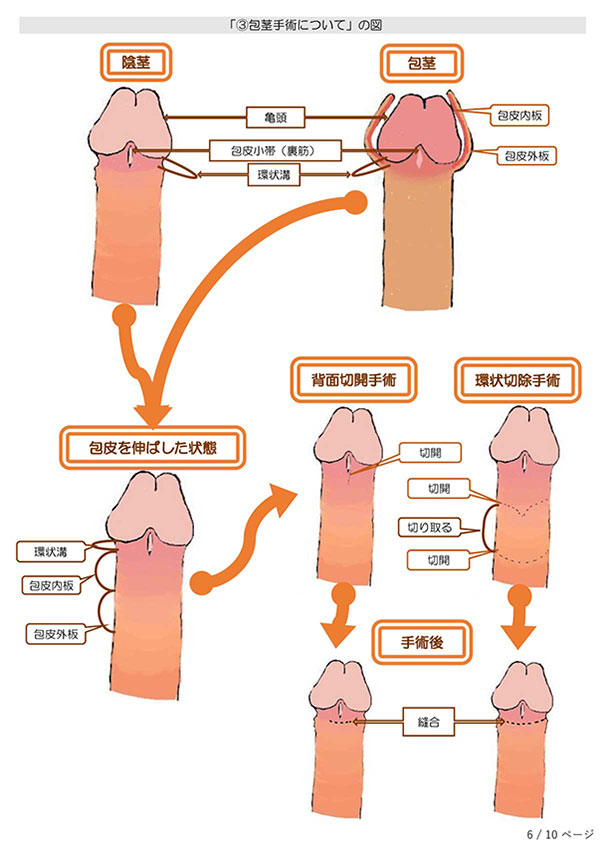 どうしてもオナニーがしたい？亀頭包皮炎について解説 - YouTube