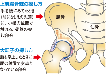 医学界新聞プラス ［第1回］腰部脊柱管狭窄症の術後リハビリテーション 手術当日～2日目まで |