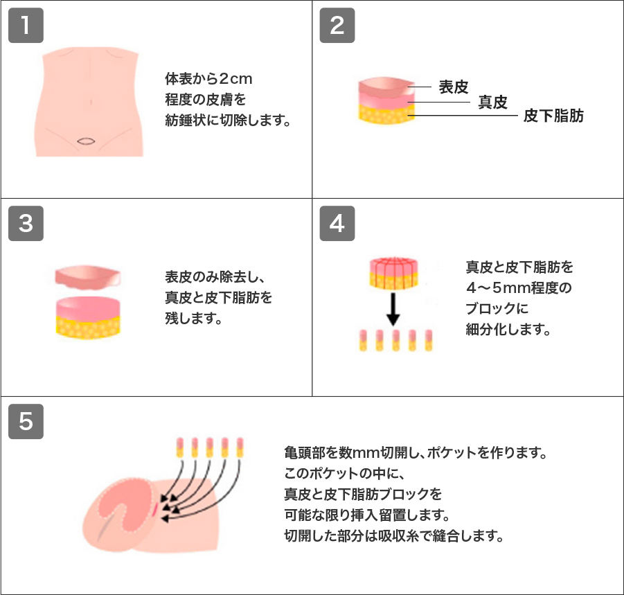 亀頭が痛い・敏感過ぎる！亀頭過敏の原因と治療方法｜包茎手術なび