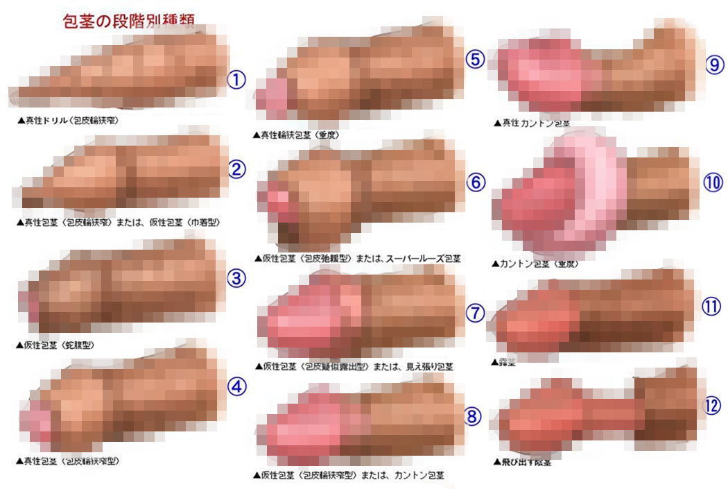 後背位（バックの体位）の正しいやり方は？コツを動画紹介 - 夜の保健室