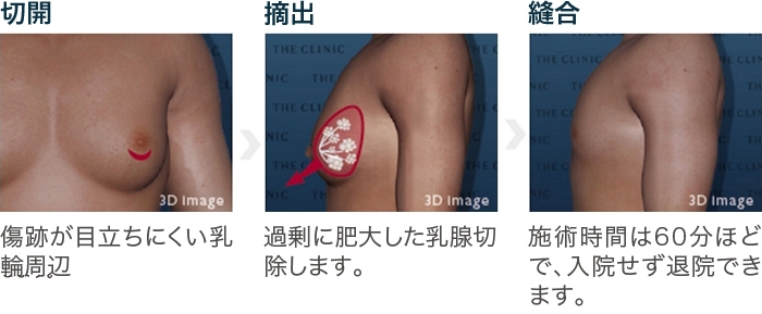 Amazon.co.jp: 「ワタシ、毎日乳首勃起してます」ニョキっと浮き出た乳頭がコンプレックスの香港ハーフ希子ちゃん 恥じらう乳首をネットリ粘着責めしたら雌汁濡らしっぱなしで本性さらけ出しSEX（ファーストスター）  [DVD]