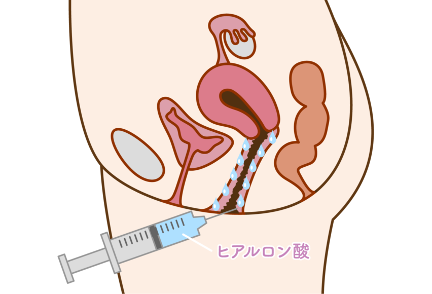 変態女子のたしなみ】吸い付く膣で男性をメロメロにする方法教えちゃいます♪ | Trip-Partner[トリップパートナー]