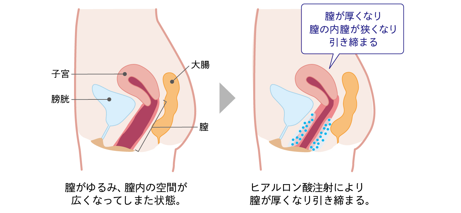 陵○2～膣内開発～ [C8] | DLsite 同人