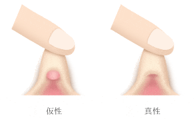 ペニスとクリトリス「勃起・形・メカニズム」の違い【比較完全図解】 | セクテクサイト