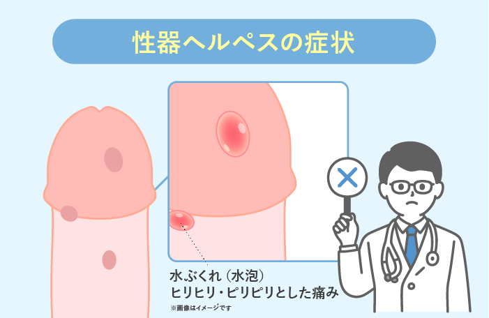 性器のできものコレって性病？ - 風俗コラム【いちごなび】