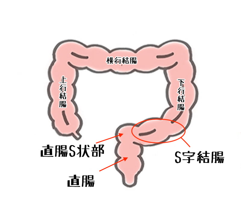 S字結腸に射精されるまでイキっぱなしな個性事故 - 同人誌 -