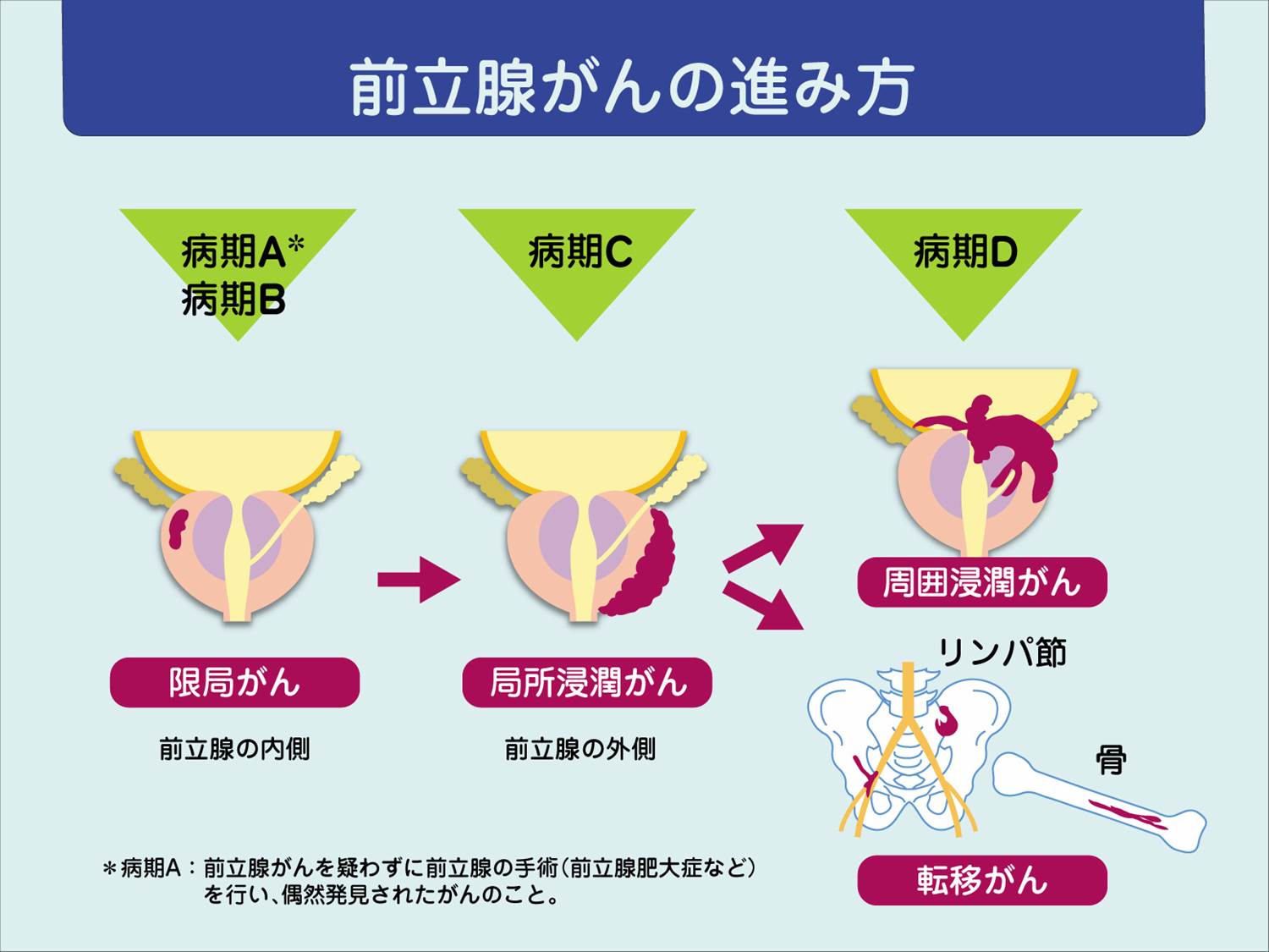 前立腺マッサージでドライオーガズム初体験がしたいなら、変態紳士倶楽部大阪店の痴女におまかせを｜大阪のＭ性感お役立ち情報