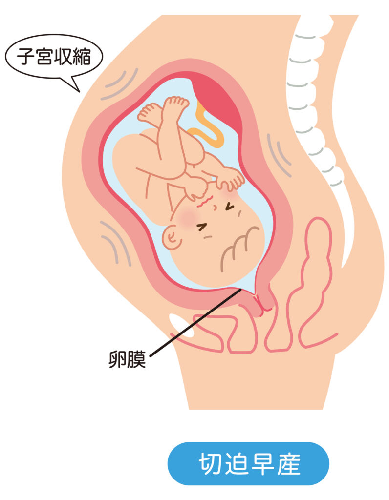 縛るか縛らないか-コンドームの後始末 1-[ビバノン循環湯 38]