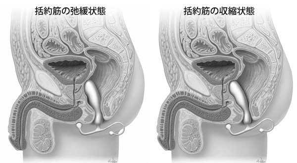 ANEROS（アネロス） ヒリックスシン ブイ≪医療?前立腺マッサージ器の第五世代！≫