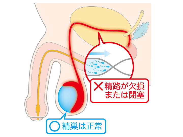 女医が解説！夢精ってなんで起こるの？？【エッチな夢で射精？】 ｜ TAクリニックグループ｜美容整形・美容外科｜全国展開中｜