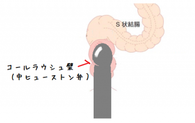 メスイキ特集 おんなのこにしてあげる】お尻を弄られ、感じて悶えて…「いれてほしい？」と熱いモノをあてられて…!! - まんが王国