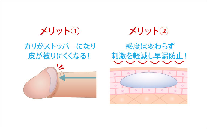 長茎手術に後悔しないポイントは？失敗のリスクと後遺症からクリニック選びのポイントを解説 | 包茎治療について｜おき泌尿器科クリニック｜富田林市の泌尿器科