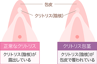 婦人科形成はヴィンテージビューティークリニック 横浜で！